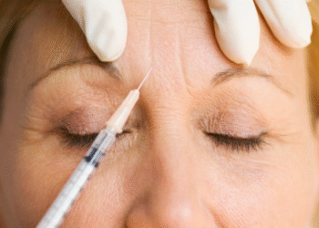 Wie Faltenbehandlungen helfen können, das jugendliche Aussehen zu bewahren