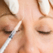 Wie Faltenbehandlungen helfen können, das jugendliche Aussehen zu bewahren